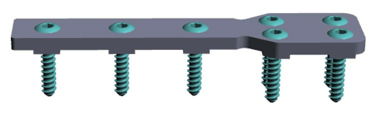PBCTWO-4